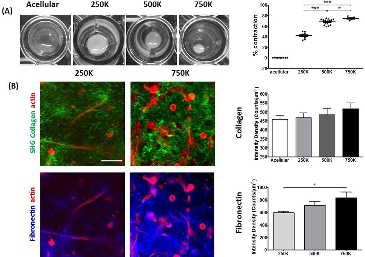 Quantitative analysis of 3D extracellular matrix remodelling by pancreatic stellate cells